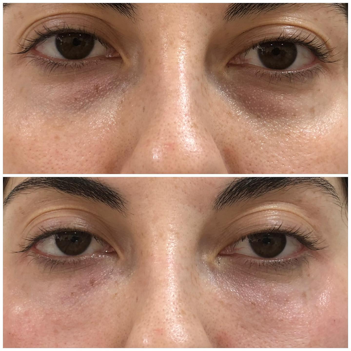 Wavy: Crema Reafirmante Instantánea para Ojos ✨