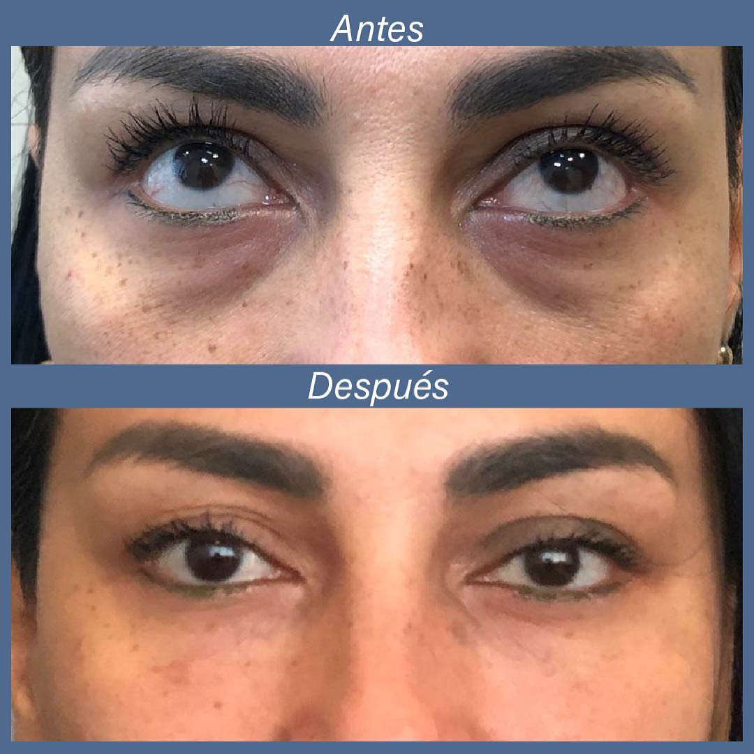 Wavy: Crema Reafirmante Instantánea para Ojos ✨