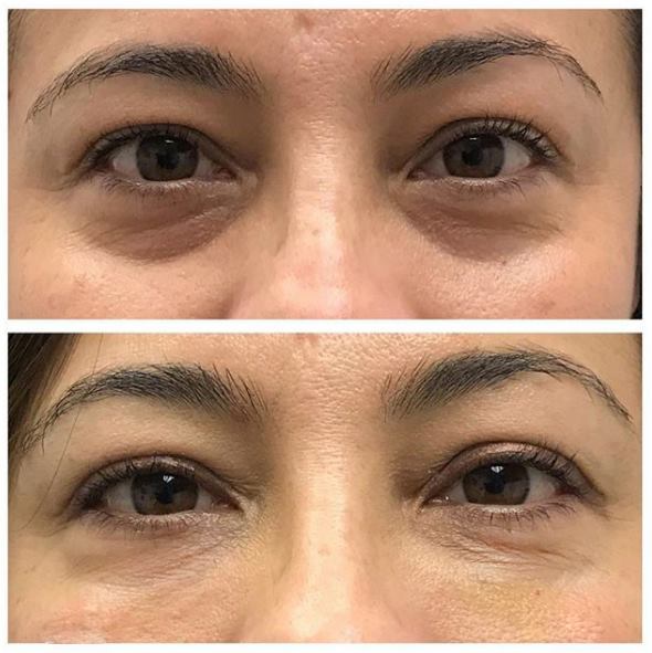 Wavy: Crema Reafirmante Instantánea para Ojos ✨