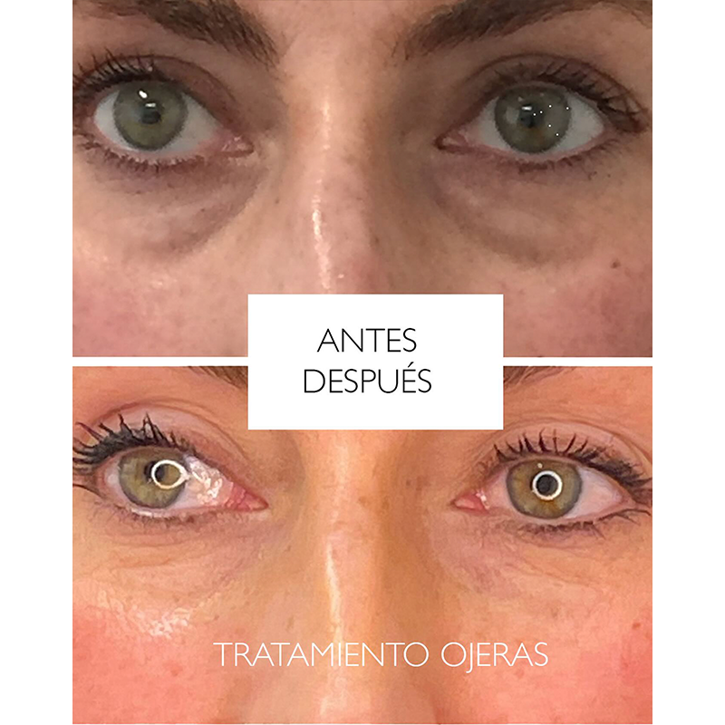 Wavy: Crema Reafirmante Instantánea para Ojos ✨