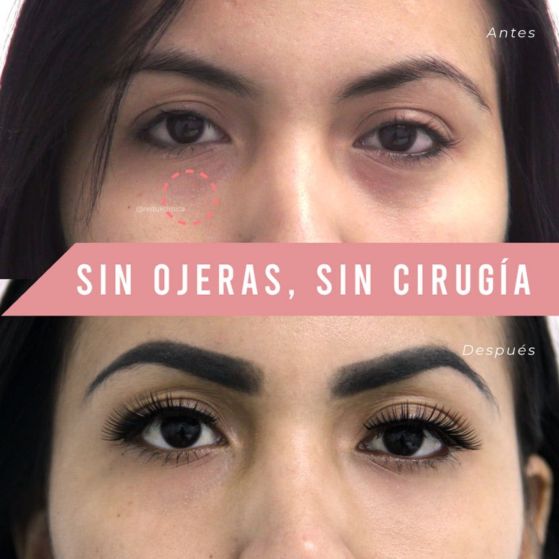 Wavy: Crema Reafirmante Instantánea para Ojos ✨