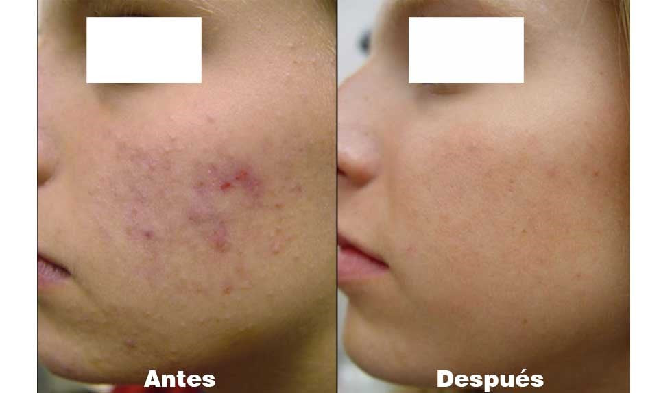 Jiyu: Pads Faciales Coreanos de Colágeno ✨