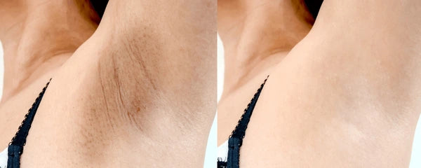 Jiyu: Pads Faciales Coreanos de Colágeno ✨