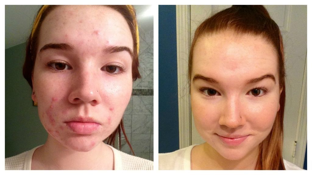 Jiyu: Pads Faciales Coreanos de Colágeno ✨